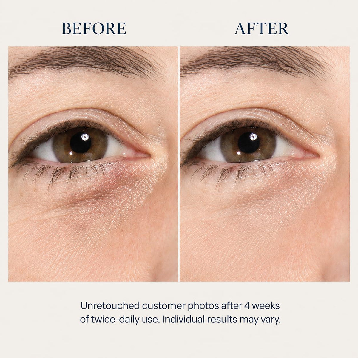 Osmotics Under Eye Rejuvenator – Peptide Eye Serum for Dark Circles, Puffiness, Bags & Fine Lines, Brightening Under Eye Treatment for Crepey Lids, Sensitive Skin, 0.5 Fl Oz