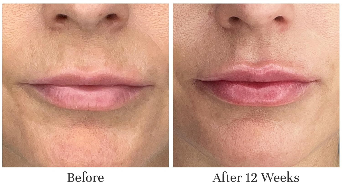 City Beauty Lip Fix + Bundle - Gloss, Night Oil & Line Therapy Trio
